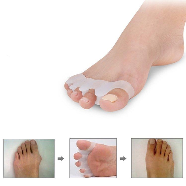 Hallux Valgus Tåspridare